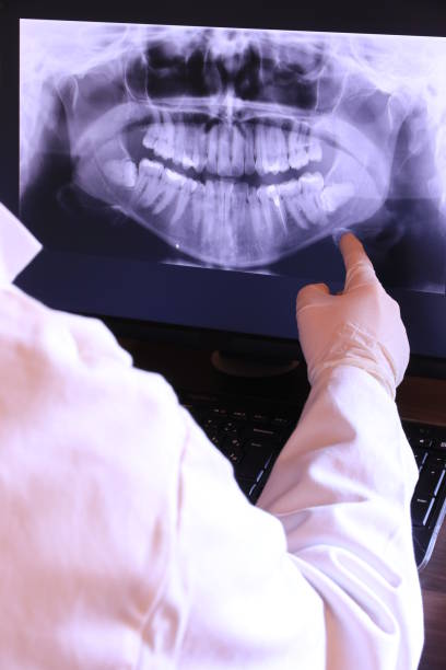 Best Emergency Dental Care for Broken or Chipped Teeth in Chesnut Hill, PA
