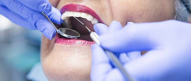 Best Emergency Treatment for Dental Infections or Abscesses in Chesnut Hill, PA